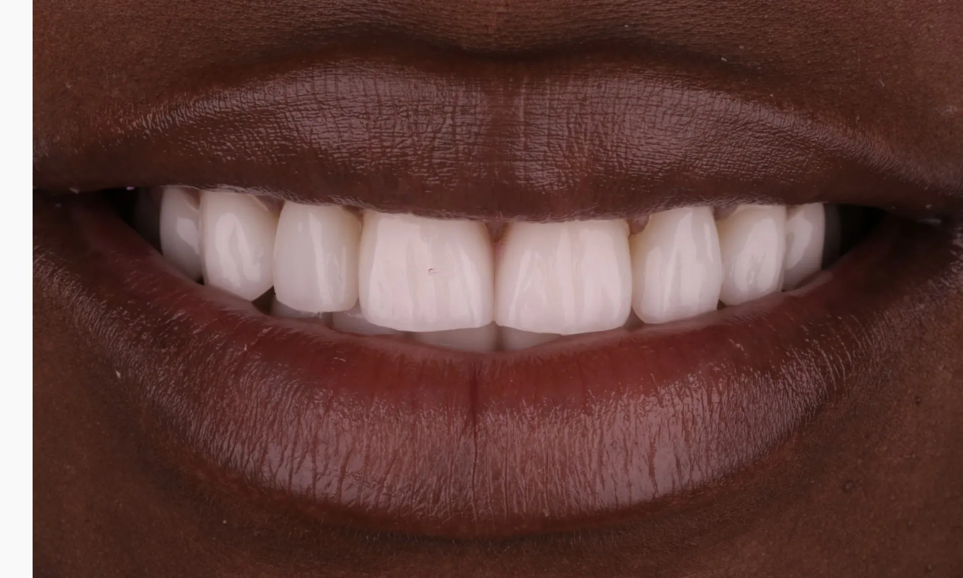 Harding Dental Group