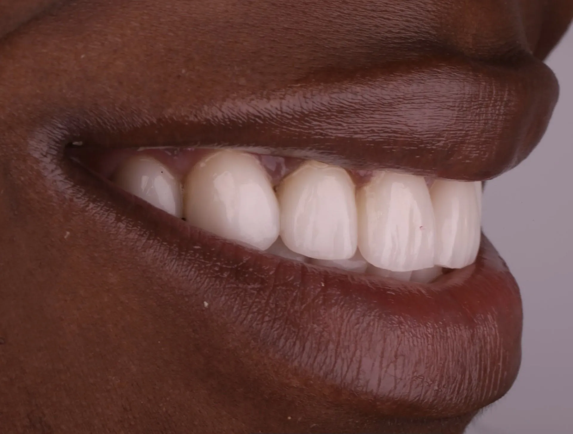 Harding Dental Group