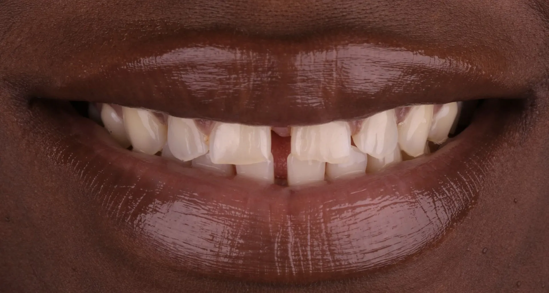 Harding Dental Group