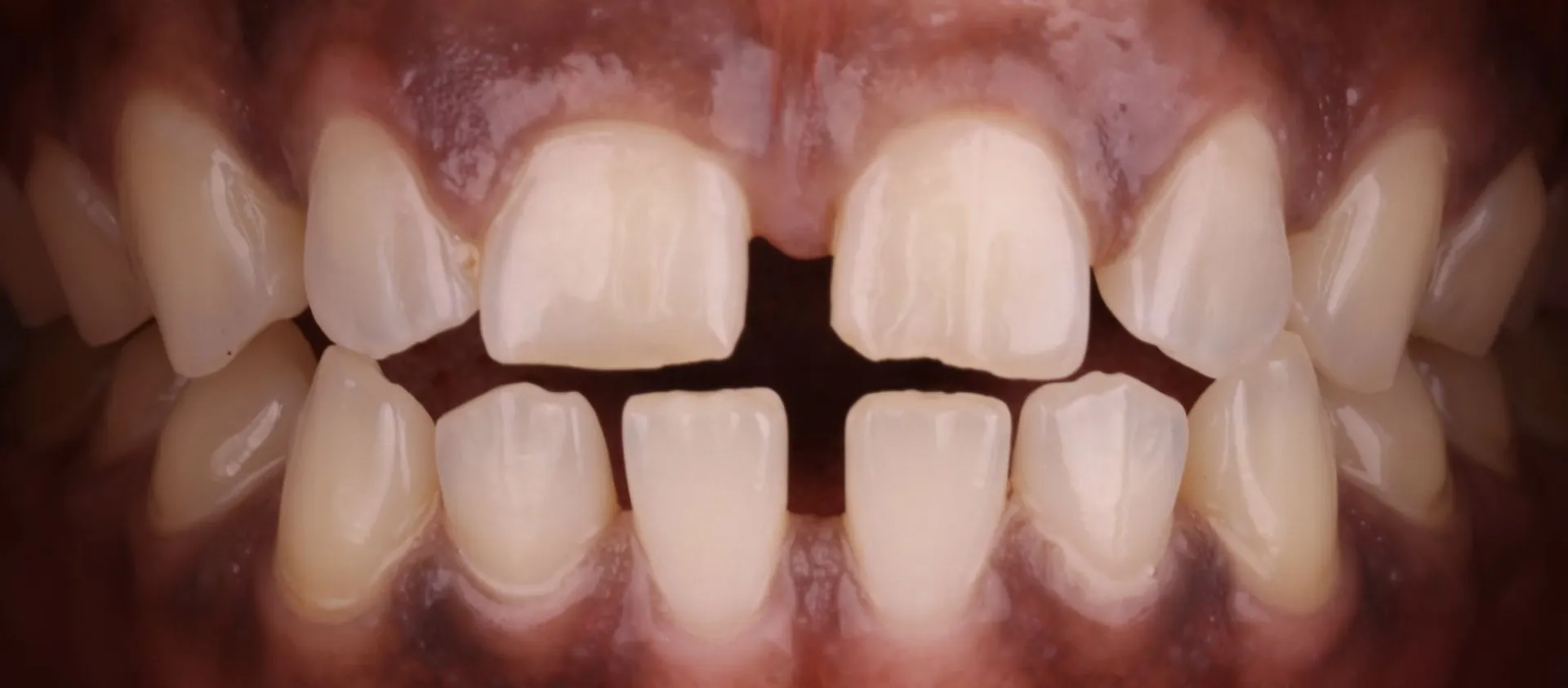 Harding Dental Group